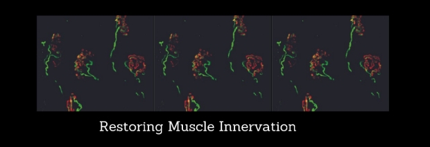 Restoring Muscle Innervation
